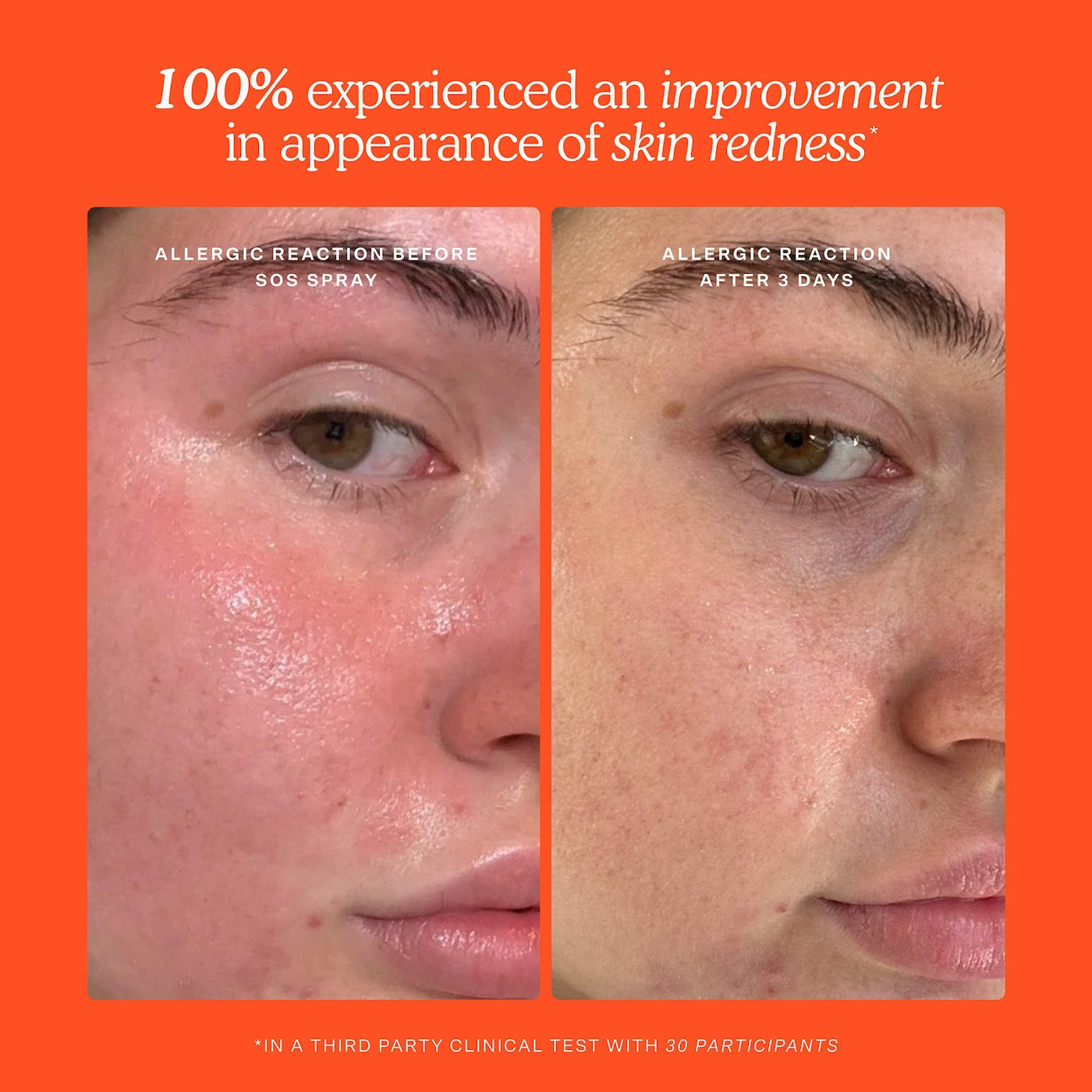 TOWER 28 Mini SOS Skincare Bestsellers Set *PRE ORDER*