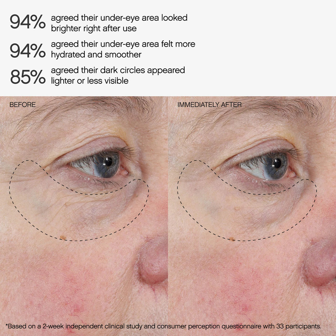 TOPICALS Faded Under Eye Brightening & Clearing Eye Masks *PRE ORDER*