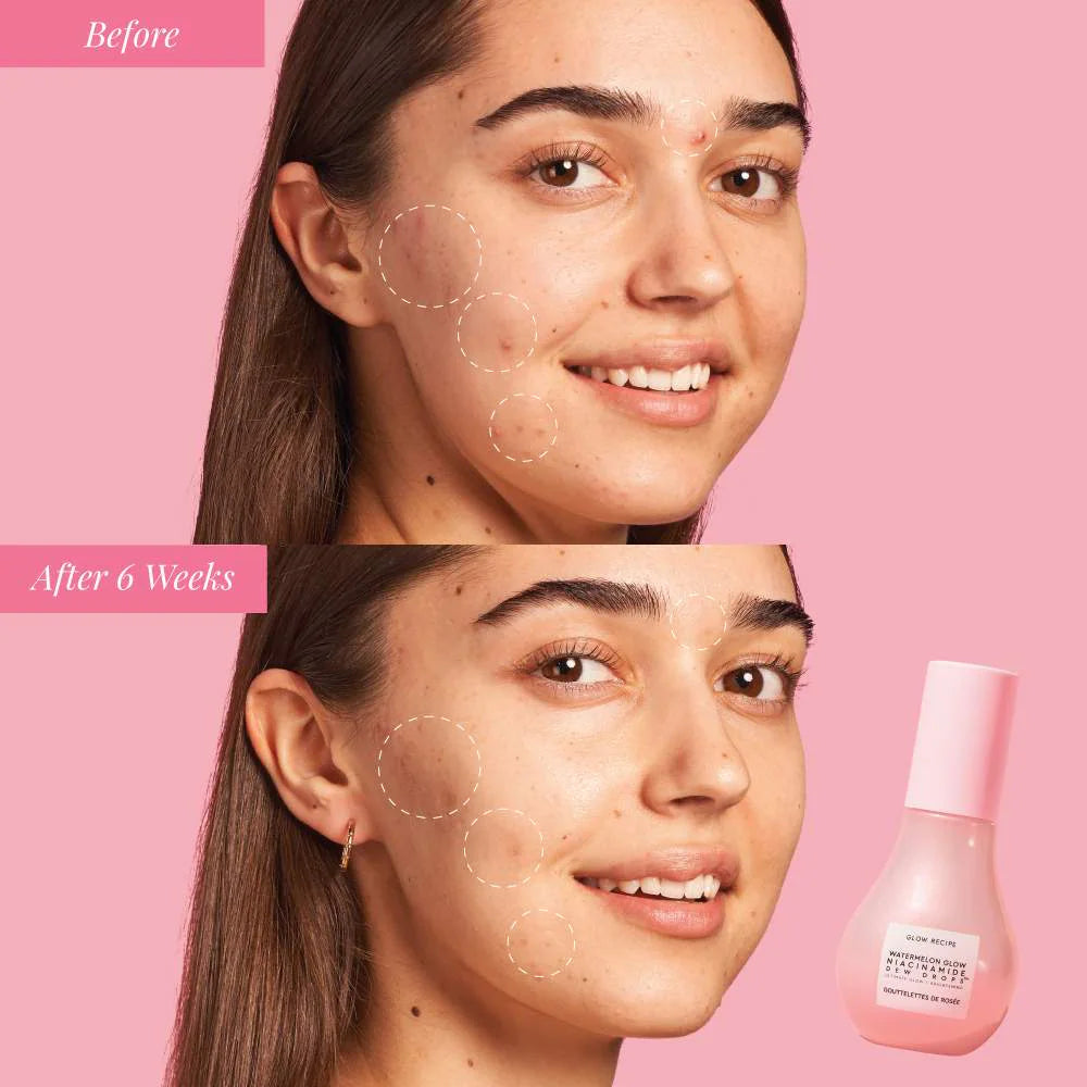 GLOW RECIPE Glow & Go Summer Essentials Kit with Niacinamide *PRE ORDER*
