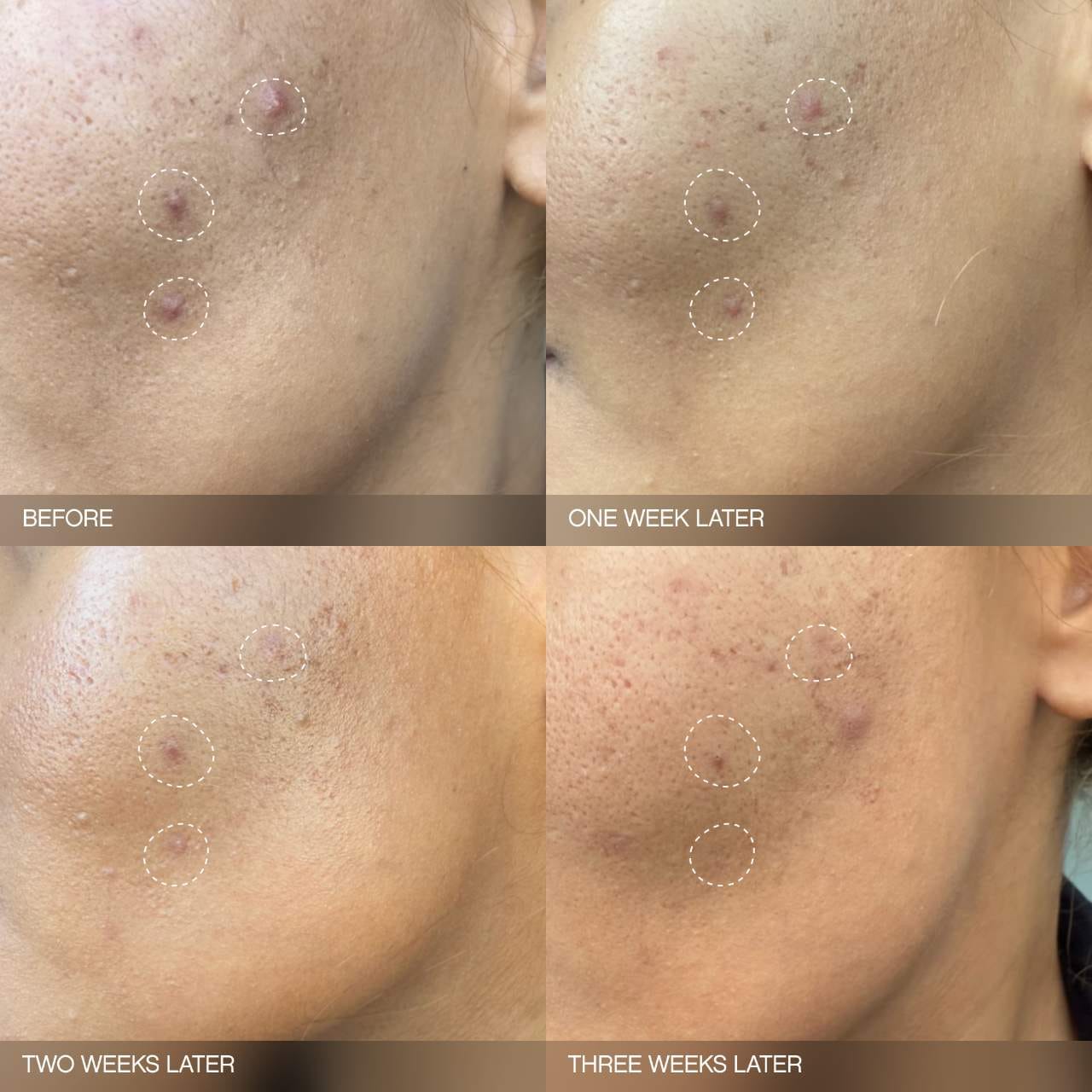 TOPICALS Faded Brightening Bundle for Discoloration on Face & Body (UNSCENTED) *PRE ORDER*