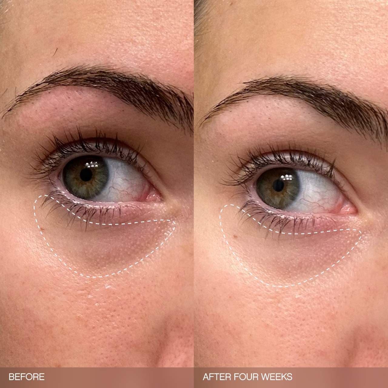 TOPICALS Faded Brightening Bundle for Discoloration on Face & Body (UNSCENTED) *PRE ORDER*