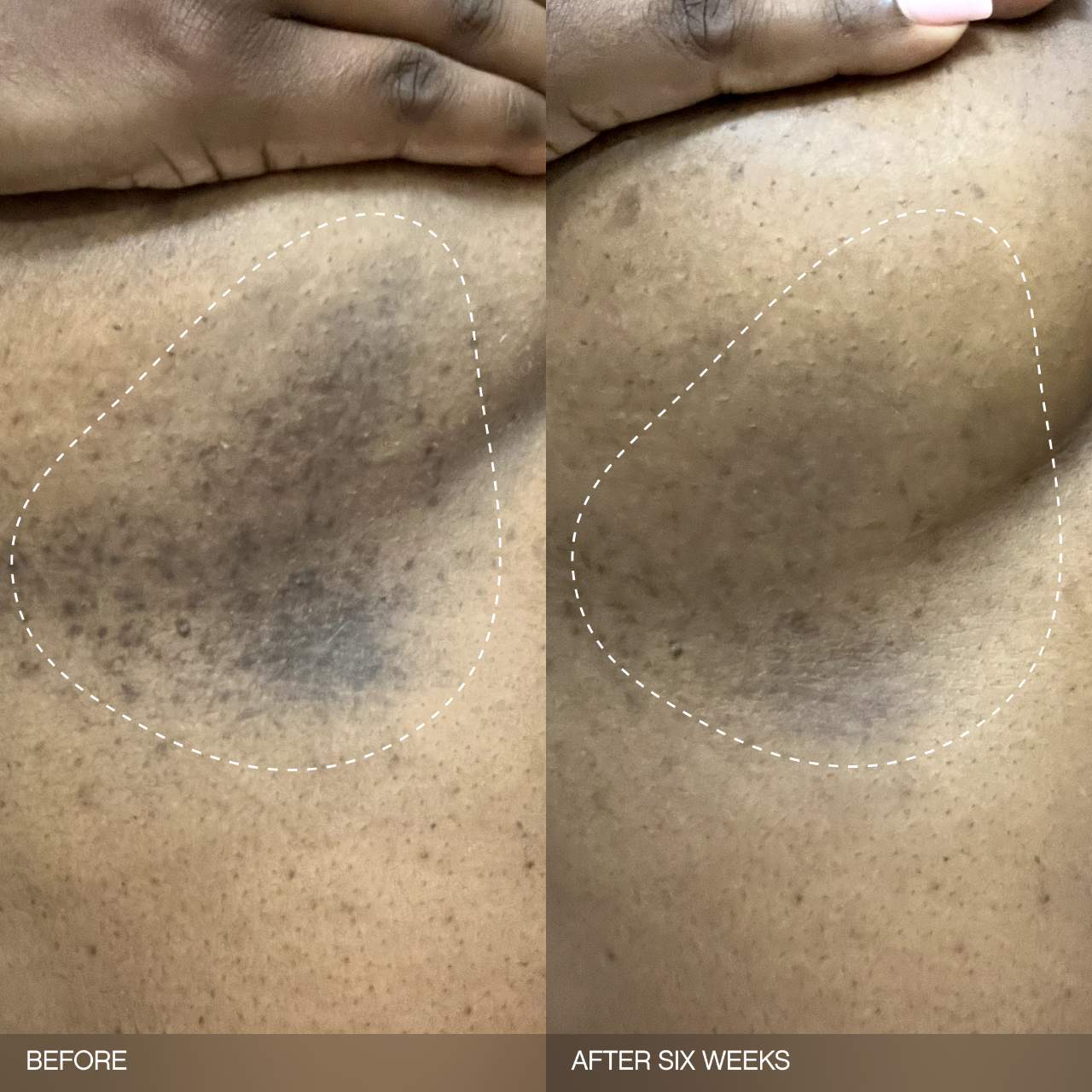 TOPICALS Faded Brightening Bundle for Discoloration on Face & Body (UNSCENTED) *PRE ORDER*