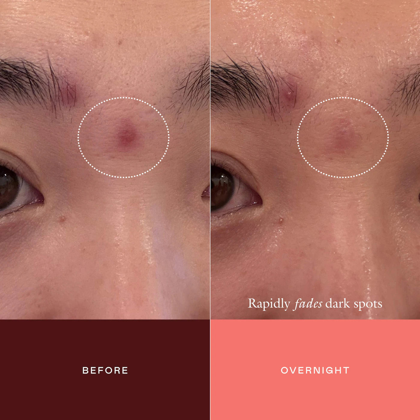 EADEM The Mark Advanced Targeted Dark Spot Concentrate with 5% Tranexamic Acid, 1% Alpha Arbutin & 1% Kojic Acid for Hyperpigmentation, Acne Marks & Age Spots *PRE ORDER*