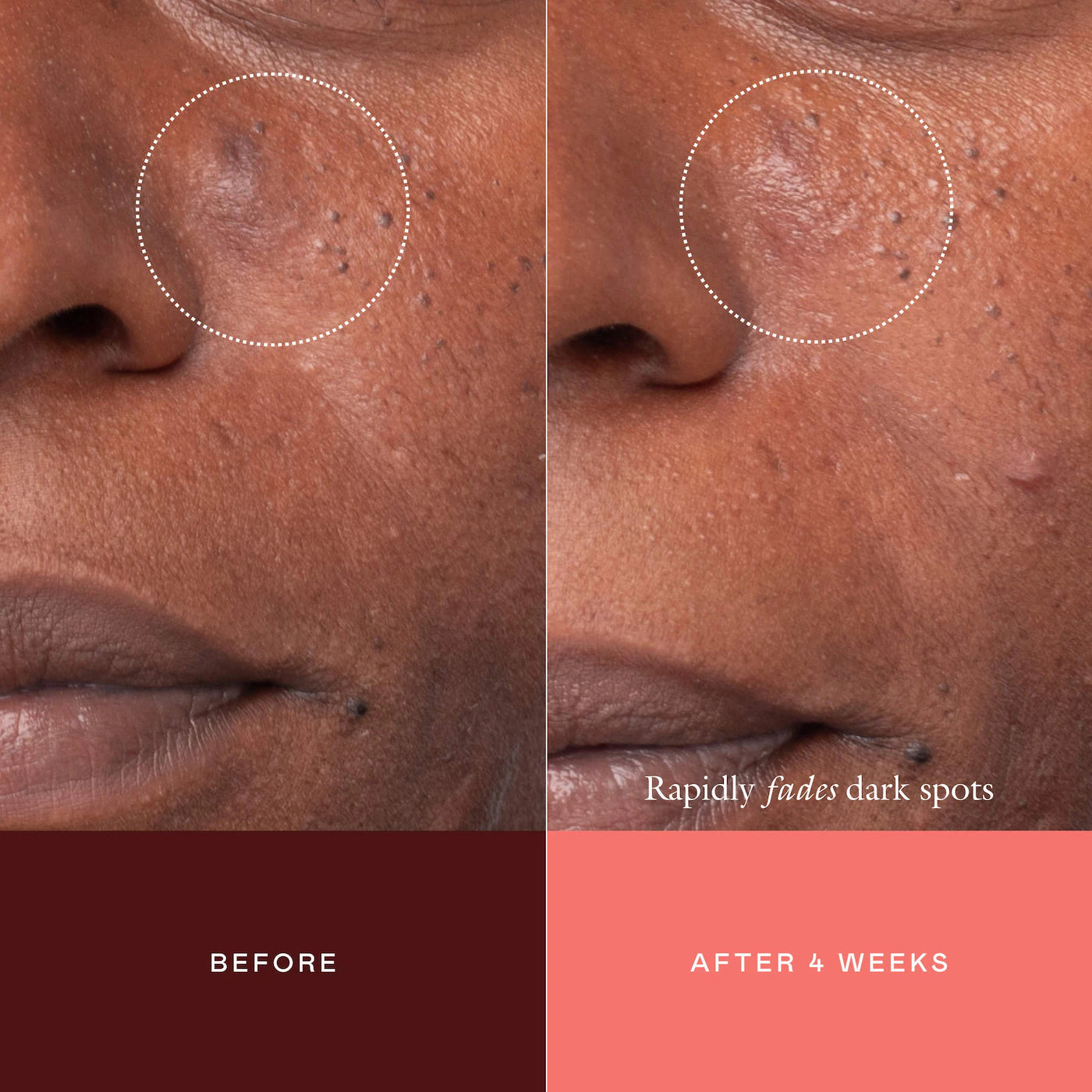 EADEM The Mark Advanced Targeted Dark Spot Concentrate with 5% Tranexamic Acid, 1% Alpha Arbutin & 1% Kojic Acid for Hyperpigmentation, Acne Marks & Age Spots *PRE ORDER*