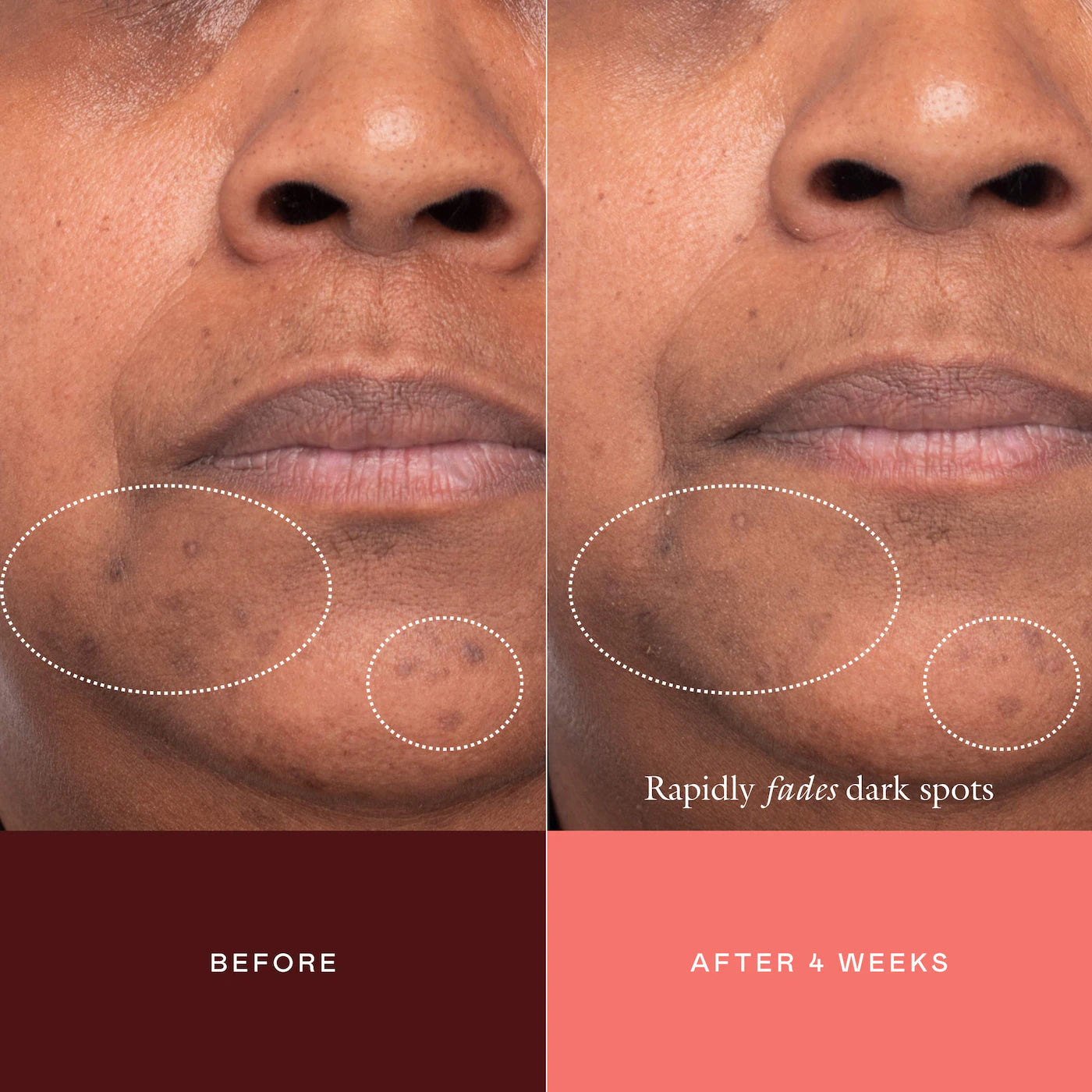 EADEM The Mark Advanced Targeted Dark Spot Concentrate with 5% Tranexamic Acid, 1% Alpha Arbutin & 1% Kojic Acid for Hyperpigmentation, Acne Marks & Age Spots *PRE ORDER*
