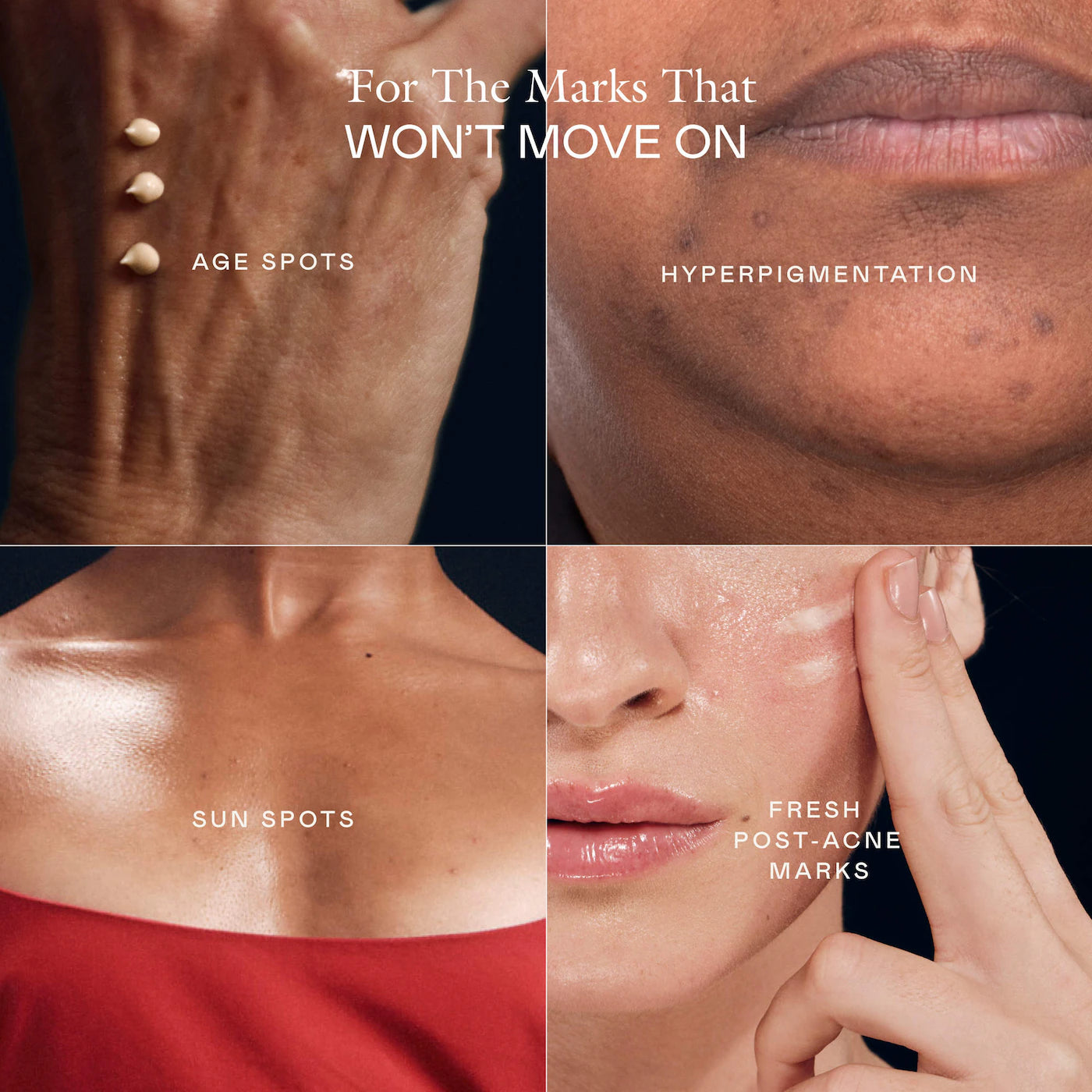 EADEM The Mark Advanced Targeted Dark Spot Concentrate with 5% Tranexamic Acid, 1% Alpha Arbutin & 1% Kojic Acid for Hyperpigmentation, Acne Marks & Age Spots *PRE ORDER*